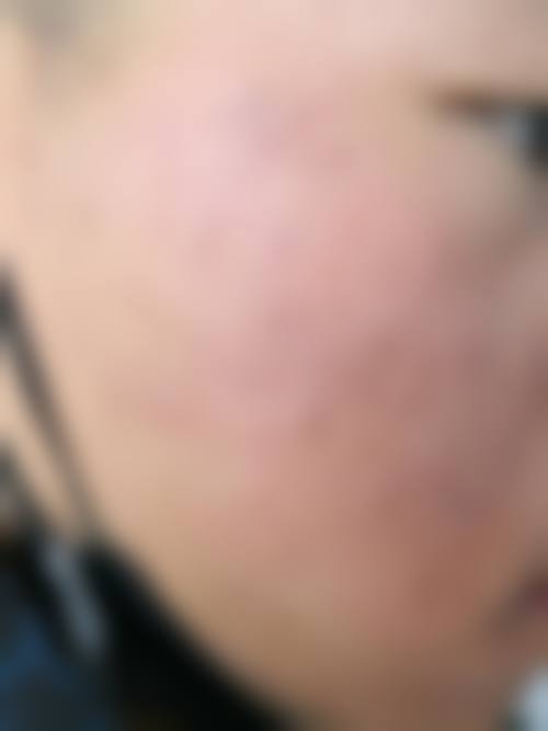 二、南宁首大医院皮肤医学美容中 心正规吗？来看看医院资质：