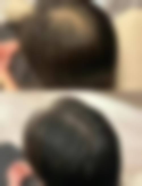 二、北京发盛园**植发医院正规吗?来看看医院资质: