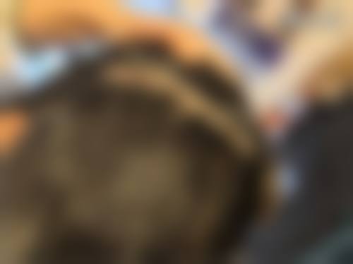 七、北京发盛园**植发医院价格表:(仅供参考)