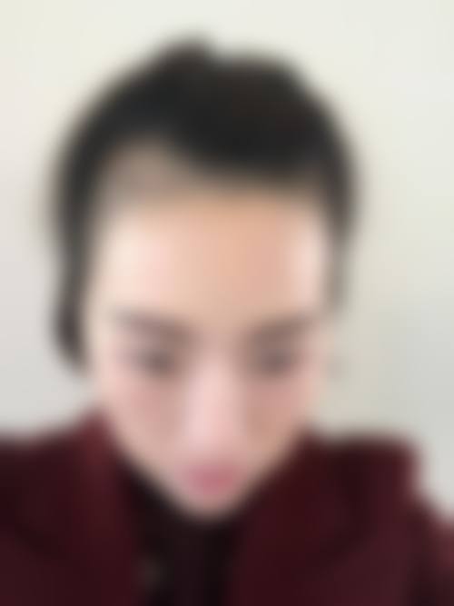 八、北京发盛园**植发医院真实的顾客评价如下: