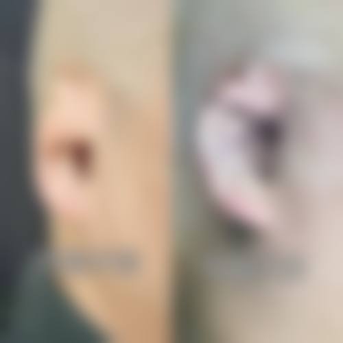 七、高要市人民医院整形激光美容科价格表：（仅供参考）