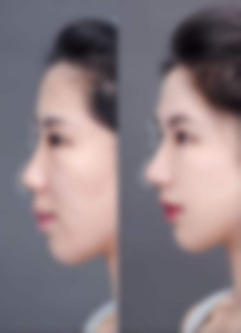 李团团医生在哪家医院怎么预约？