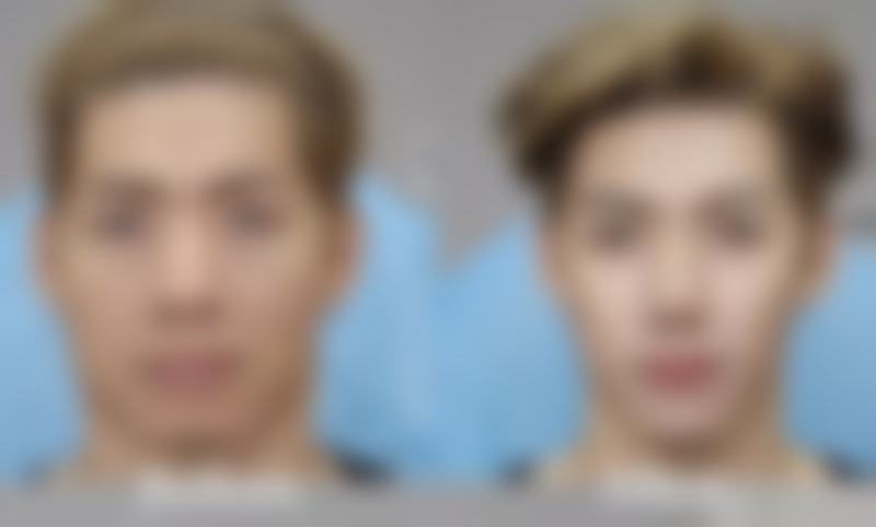 硅胶隆鼻真能一辈子不取出吗？了解取出原因与注意事项，让美更持久 