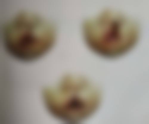 做双眼皮全切手术后，饮食与用药要科学