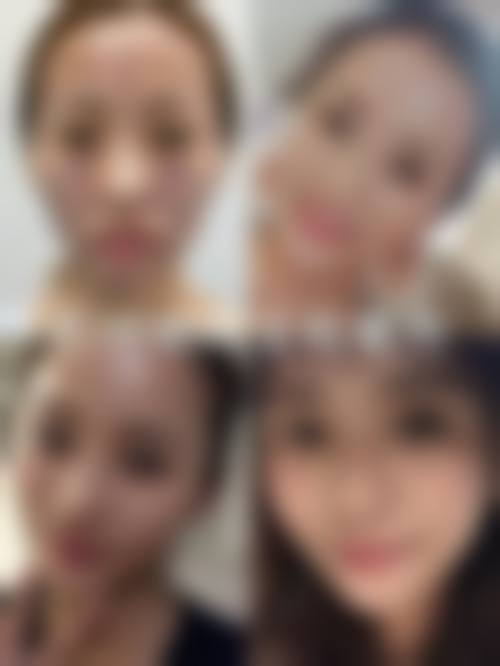 七、常州朱珠安整形医院价格表：（仅供参考）