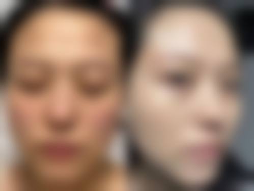 五、南京光尔美整形医院实例