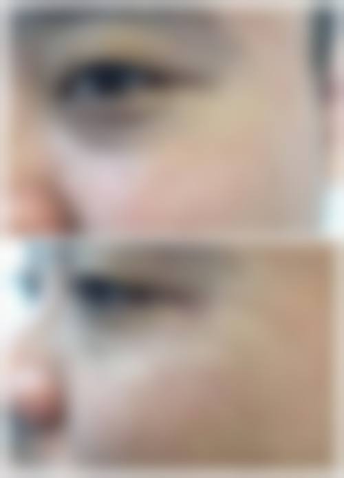 高培培医生项目价格表参考