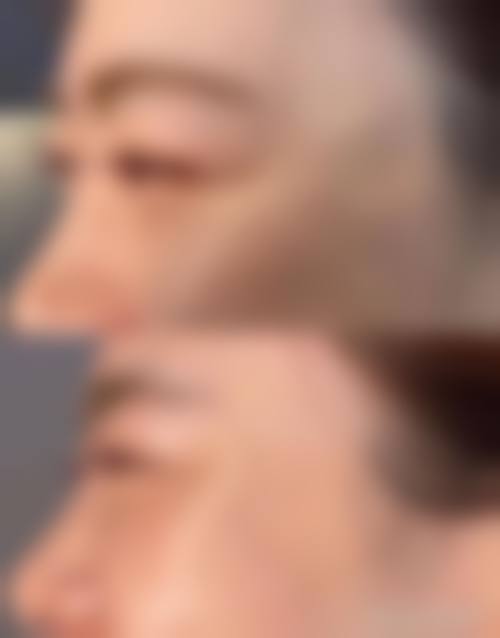 高培培医生实例