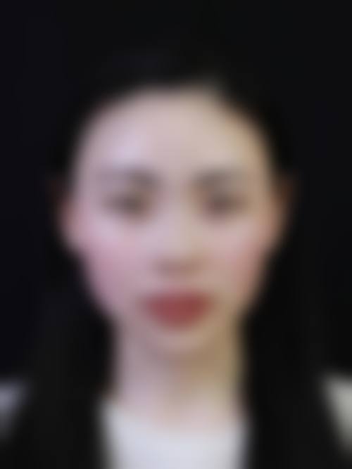 七、湖南艾丽思整形医疗美容价格表：（仅供参考）