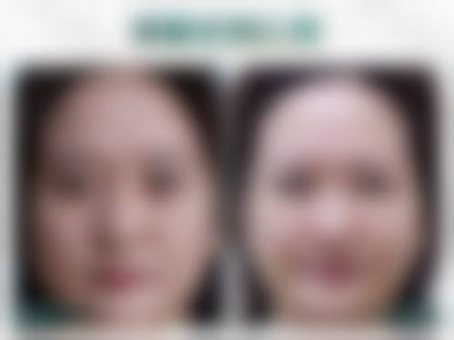 八、郑州安禾美阁整形医院真实的顾客评价如下：