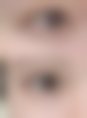 黑眼圈眼袋越来越重度，日常生活这样调理