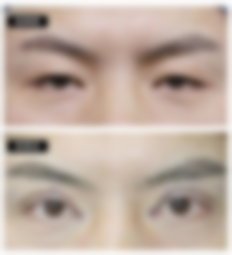 七、郑州安禾美阁整形医院价格表：（仅供参考）