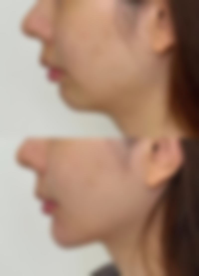 六、朝阳区麦西美嘉医疗美容门诊部怎么预约：