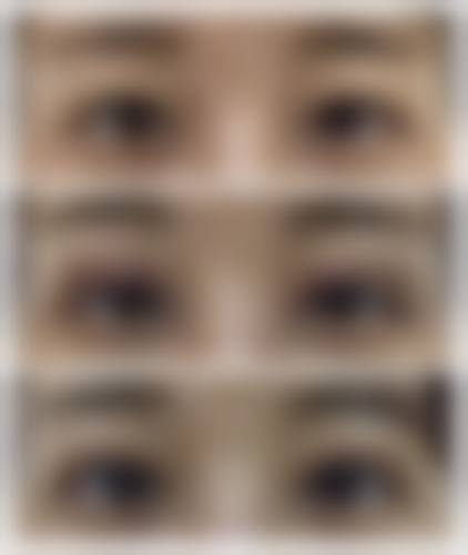 八、郴州维纳斯整形真实的顾客评价如下