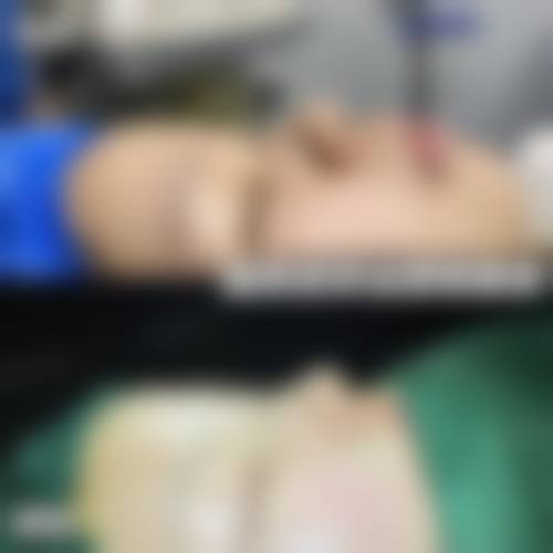 六、乌鲁木齐昕容妍医疗美容医院怎么预约: