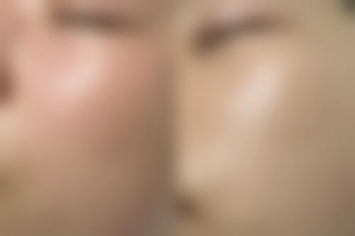 六、珠海市慢性病防治中 心美容部怎么预约: