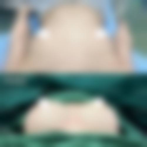 七、郴州维纳斯整形价格表:(仅供参考)