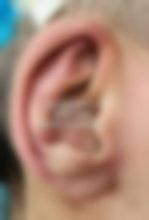 七、长沙雅肤美肤医疗美容门诊部价格表：（仅供参考）