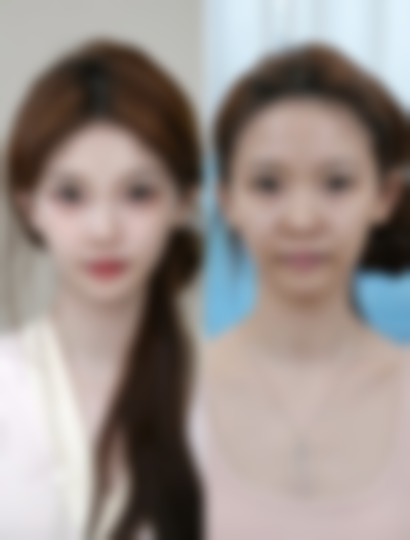 祛黑眼袋大揭秘：专精医美治疗显神通