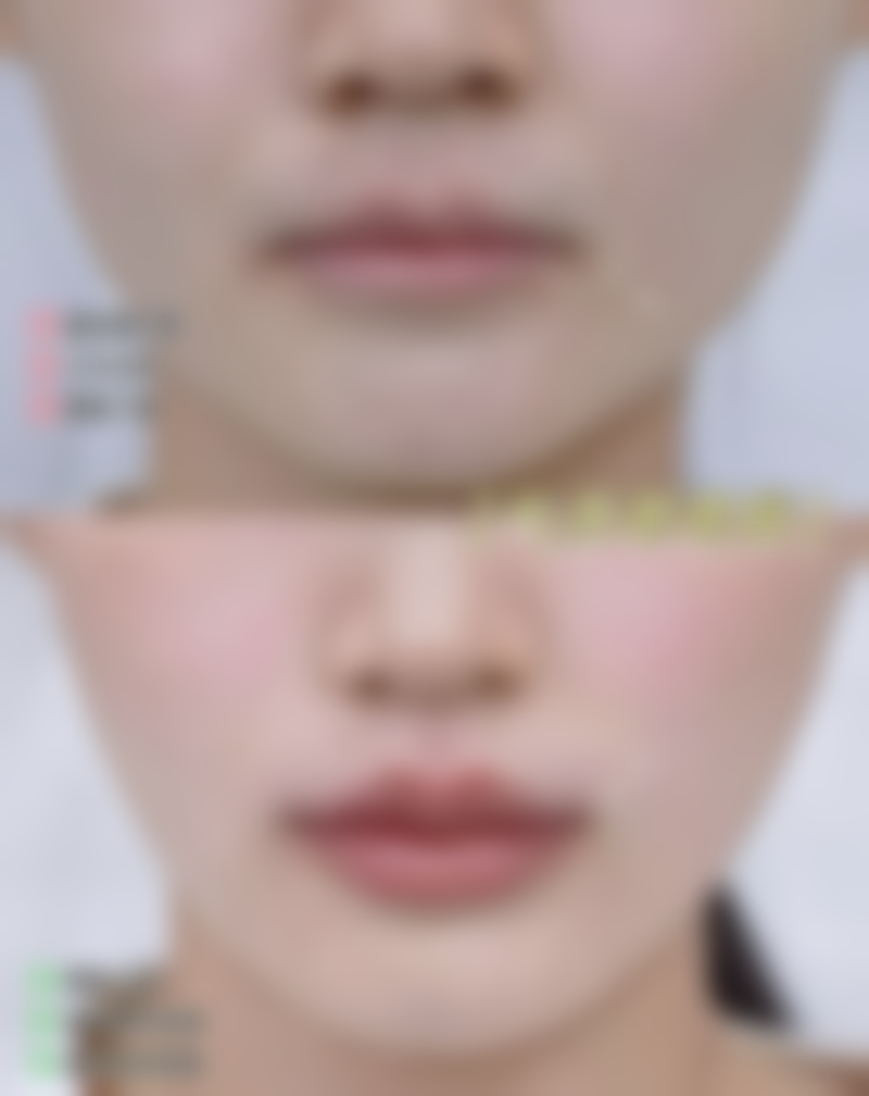 武汉斯启诺医疗美容门诊部刘敏先医生的预约方式