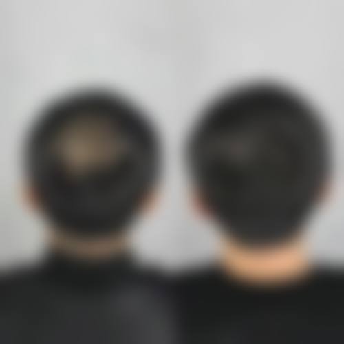 六、绵阳新生植发医疗美容诊所价格表：（仅供参考）