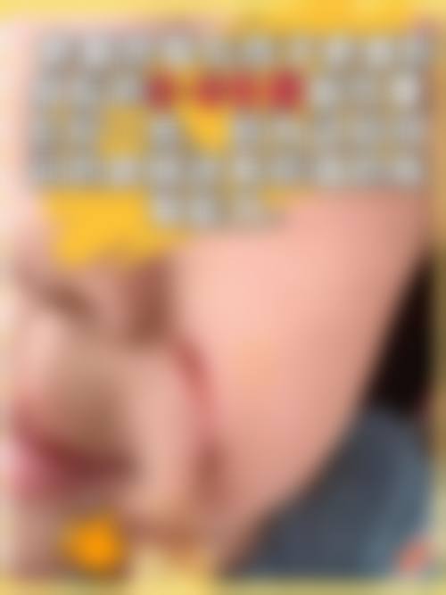 五、成都青羊区第五人民医院疤痕科实例