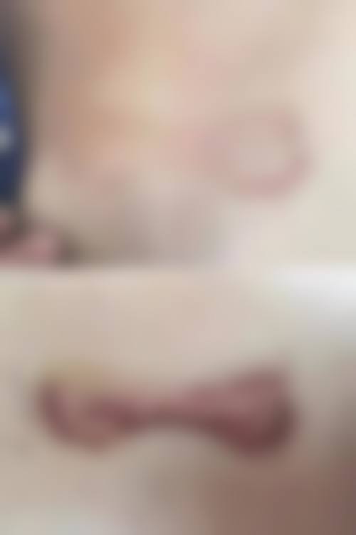 八、成都青羊区第五人民医院疤痕科真实的顾客评价如下：