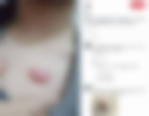 七、成都青羊区第五人民医院疤痕科价格表：（仅供参考）