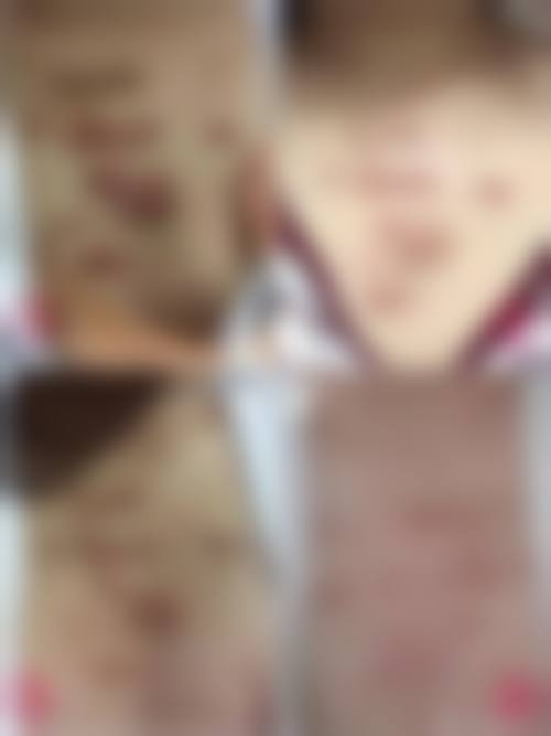 四、成都青羊区第五人民医院疤痕科基本信息：