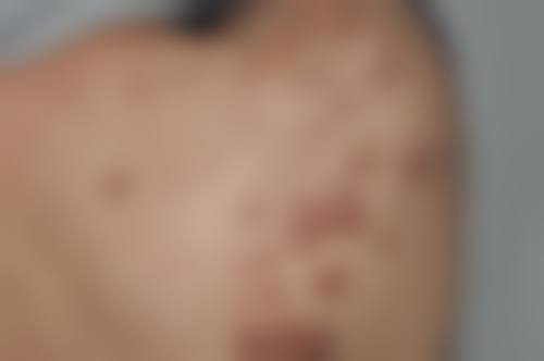 二、成都青羊区第五人民医院疤痕科正规吗？来看看医院资质：