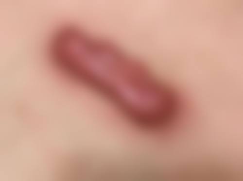 三、成都青羊区第五人民医院疤痕科医生介绍: