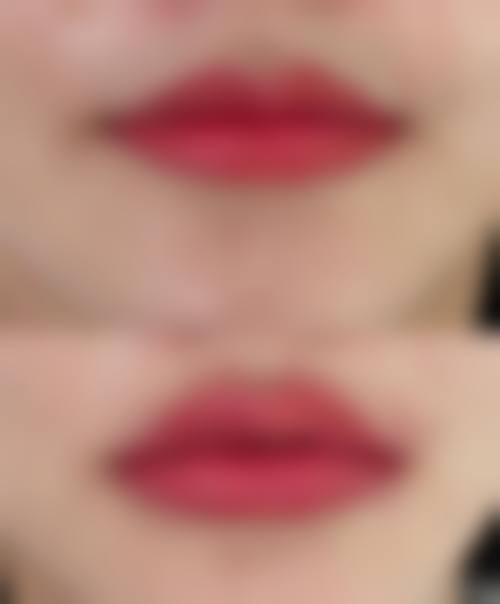 五、南宁米娅医疗美容门诊部怎么预约：