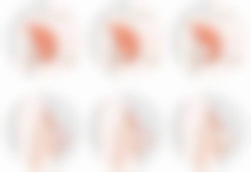 一年多陈旧凹陷疤痕，联合治疗更有效