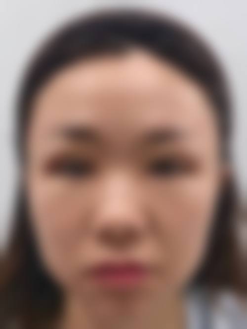 五、襄阳青橙医美医学美容门诊部实例