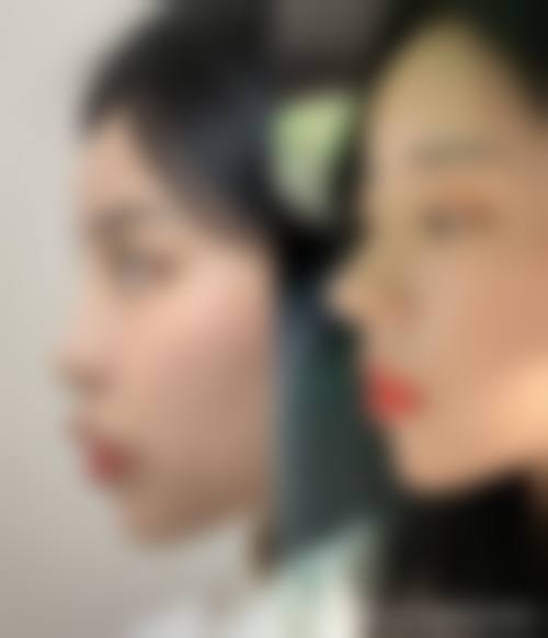 五、郑州欣荣医疗整形美容医院实例