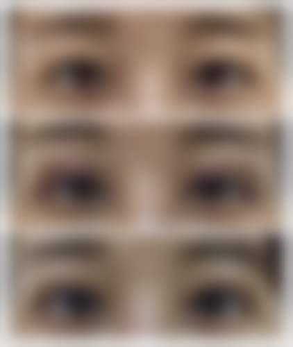 六、山东临沂星铄（鼎颜）医疗美容医院怎么预约：