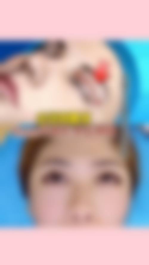 八、山东临沂星铄（鼎颜）医疗美容医院真实的顾客评价如下：