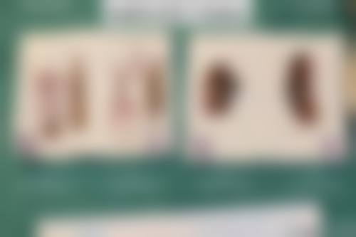 潘圣战医生怎么样可靠吗？