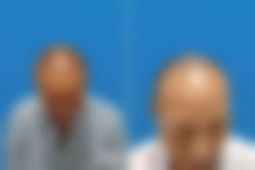 八、徐州高第植发医院真实的顾客评价如下：