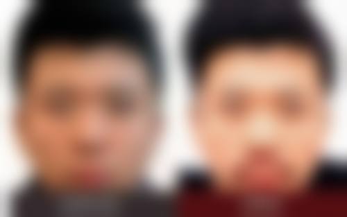 五、徐州高第植发医院实例