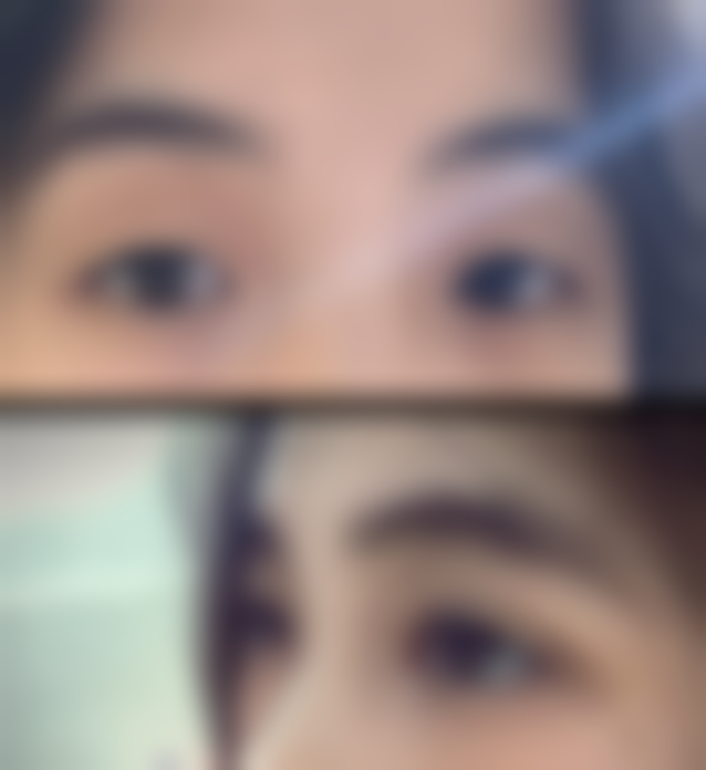 五、山东临沂星铄（鼎颜）医疗美容医院实例