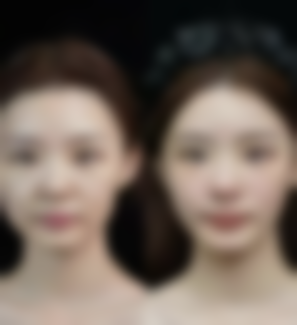 五、南昌奕祺媄整形医院怎么预约: