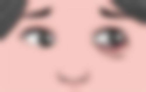 50岁女性隆胸：术后护理要点