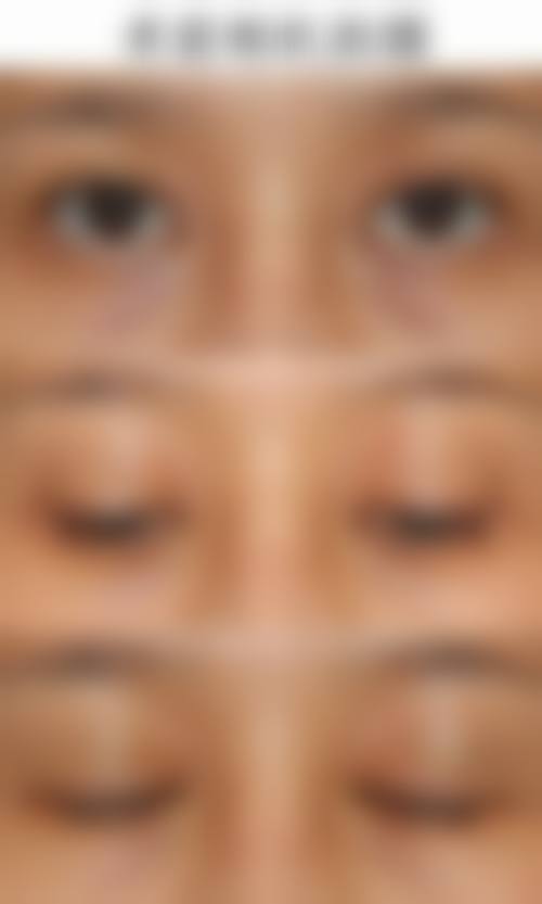 八、韩国PRIDE整形医院真实的顾客评价如下：