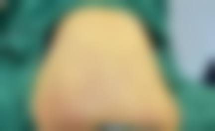 七、石家庄友谊烧伤医院美容整形科价格表：（仅供参考）