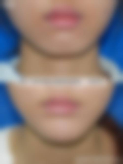 七、乐山荣瑜医疗美容诊所价格表:(仅供参考)