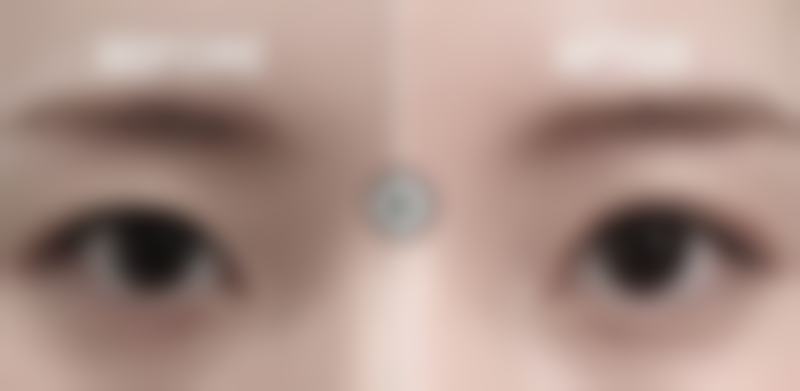 五、北京伊美尔长岛整形医学美容医院实例