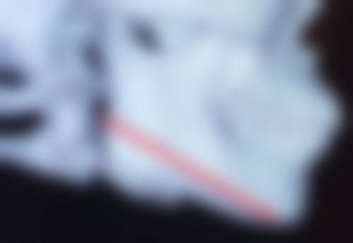 如何预约武汉斯启诺医疗美容门诊部刘敏先医生