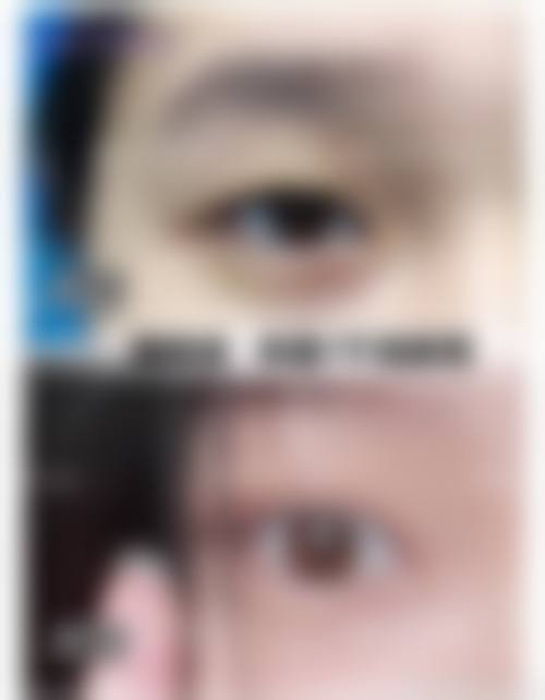 三、韩国女友整形外科医生介绍: