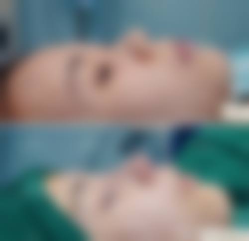 六、南宁艾媚儿整形医院价格表：（仅供参考）